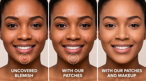 Protect, Conceal & Heal