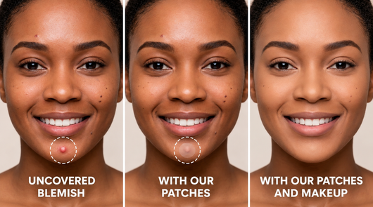 Protect, Conceal & Heal