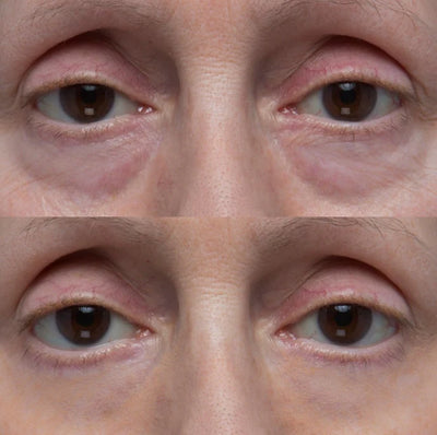 Bloomwings 60-Second Eye Effects™