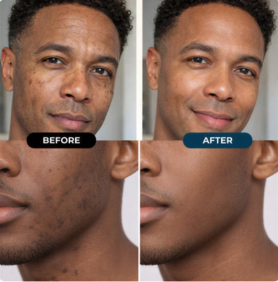 Bloomwings & Co Dark Spot Cream