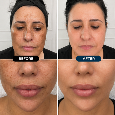 Bloomwings & Co Dark Spot Cream